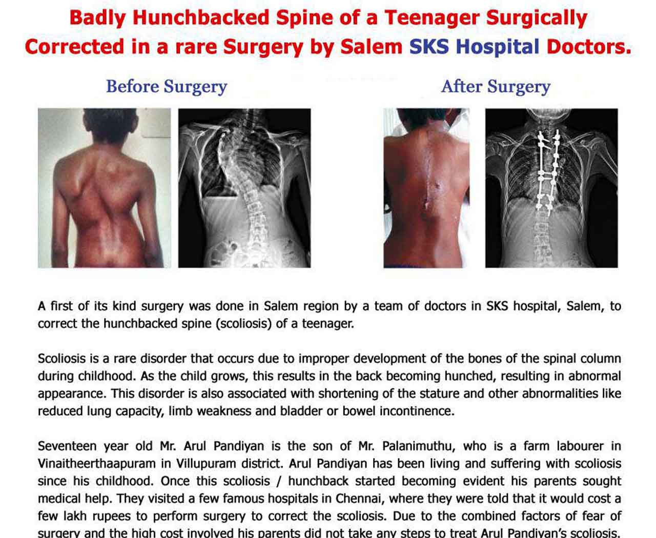 spine-surgery-salem-dr-vishnu-prasath